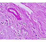 Image of Azer Scientific Control SLIDE, Glycogen ESCS-116