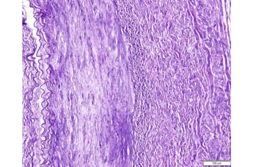 Image of Azer Scientific Control SLIDE, Elastic Tissue ESCS-111