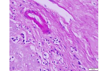 Image of Azer Scientific Control SLIDE, Glycogen ESCS-116