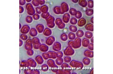 Image of Barska Slide - Blood of human smear