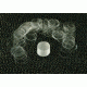 VWR Vwr Coverglass Cir #1 18mm Oz VWRCIR1-18MM, Unit ONZ