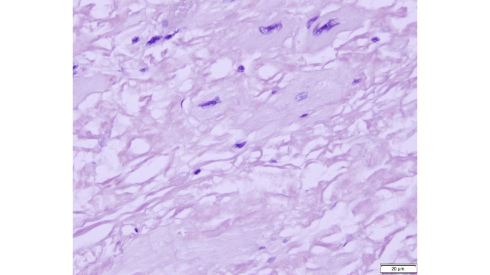 Azer Scientific Control SLIDE, Amyloid ESCS-106
