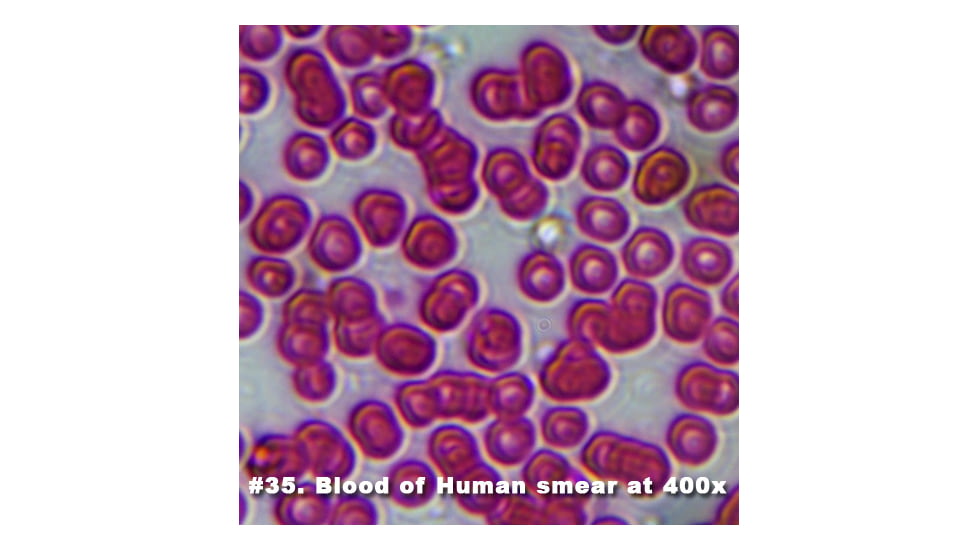 Barska Slide - Blood of human smear